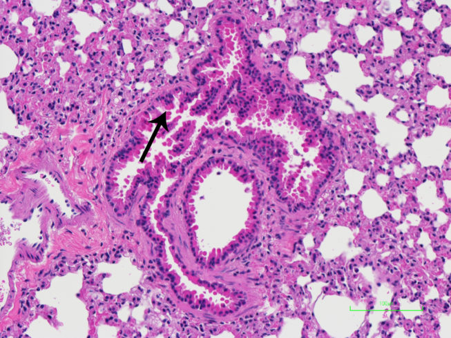 Featured Lesion #17 – Geropathology Research Consortium